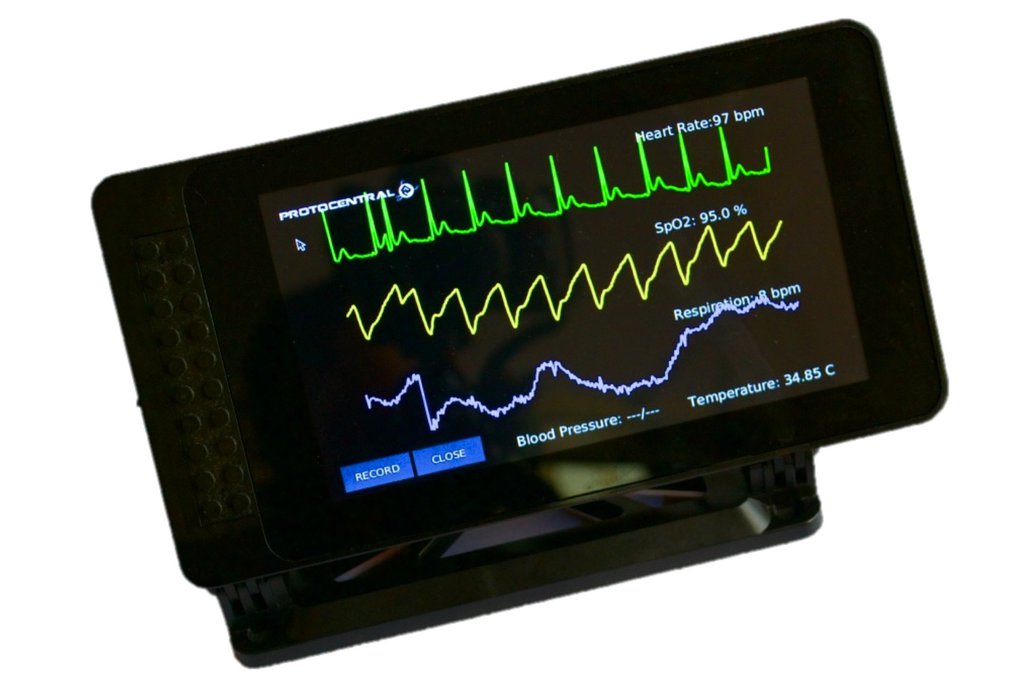 HealthyPi V3 - Complete kit with Raspberry Pi 3 1