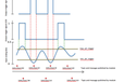 2015-08-24T21:37:05.437Z-AnalogDataResponseGraph.png